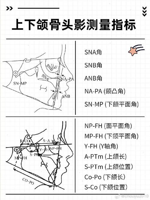 正畸头影测量标志点-图1 正畸头影测量标志点-图1