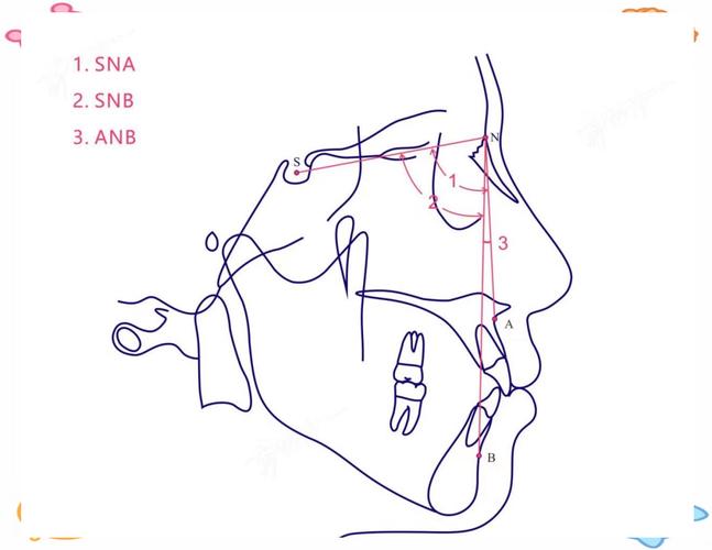 正畸头影测量标志点-图3