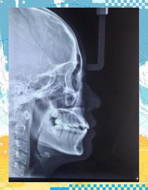 北大口腔正畸为何受欢迎？效果如何？-图1