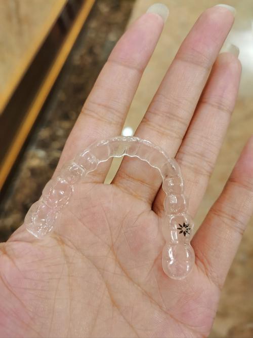 北大口腔正畸为何受欢迎？效果如何？-图2