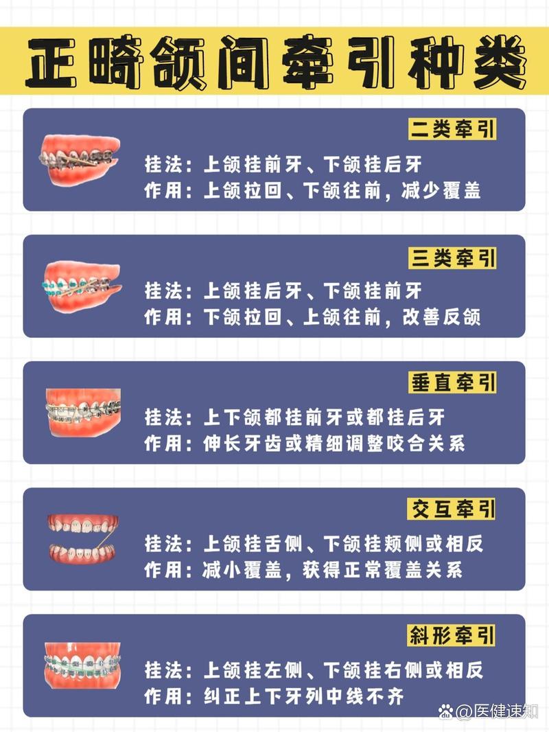 二类二分类 正畸-图1