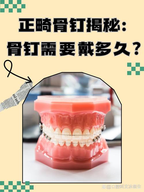 正畸三角形支抗钉-图2