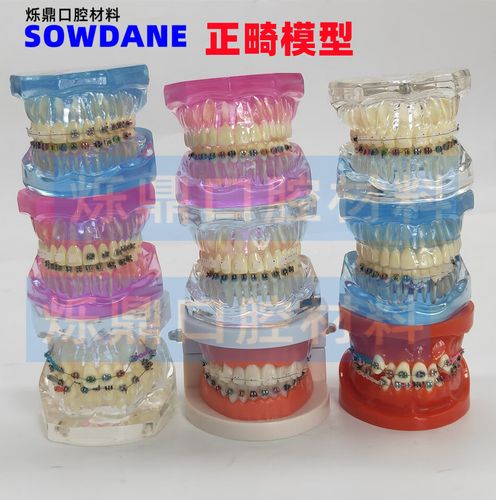 直丝弓正畸矫正器-图3