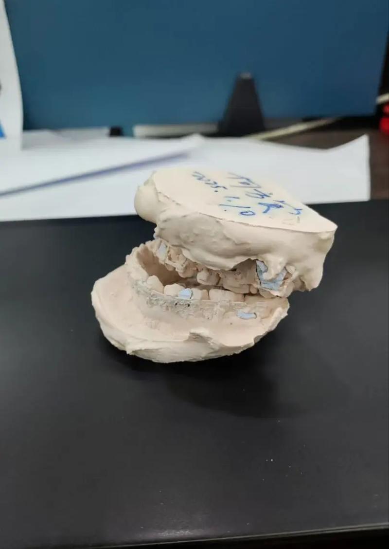 北京大学海外正畸-图2