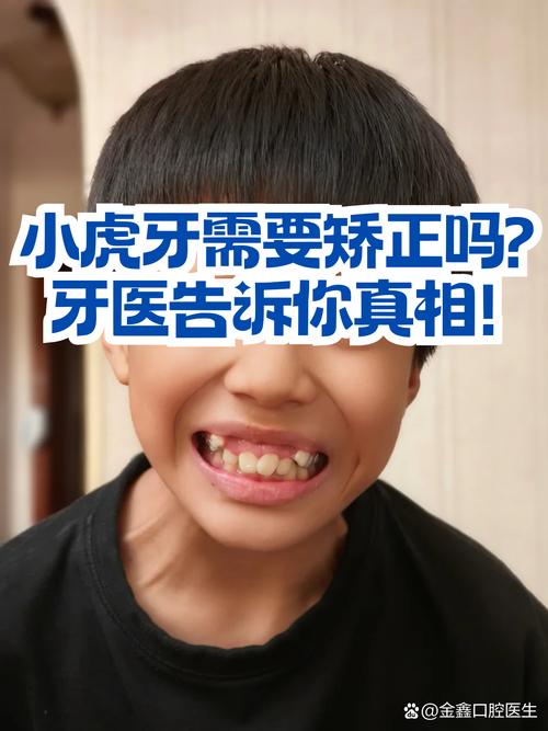 拔虎牙正畸只拔一颗效果好吗?脸型会变吗?-图1 拔虎牙正畸只拔一颗效果好吗?脸型会变吗?-图1