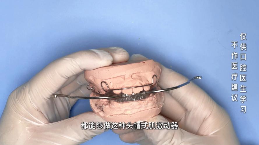 正畸矫正器有用吗？效果好不好，值不值得做？-图3