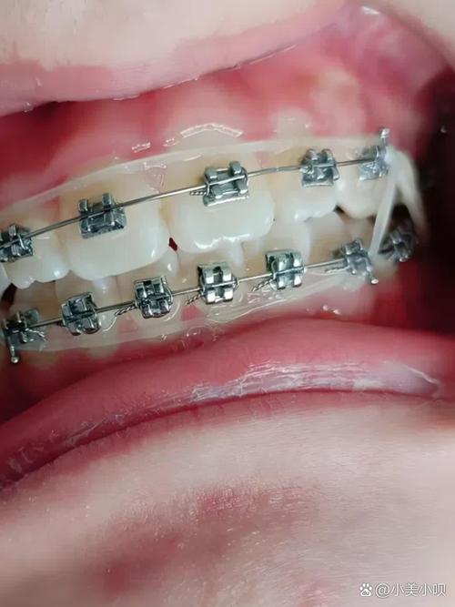 浙二口腔正畸在哪-图3