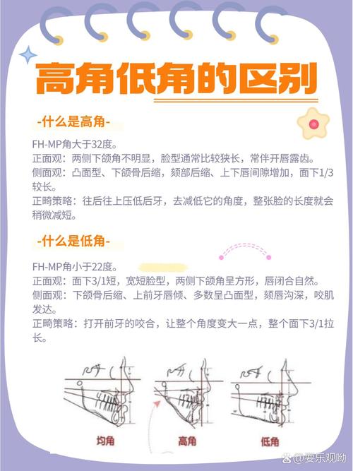 正畸说的高角低角-图2