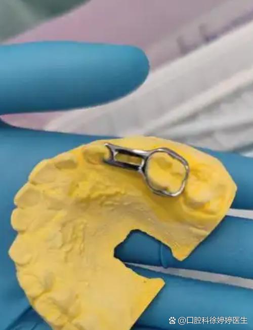 正畸一般拔什么牙-图3