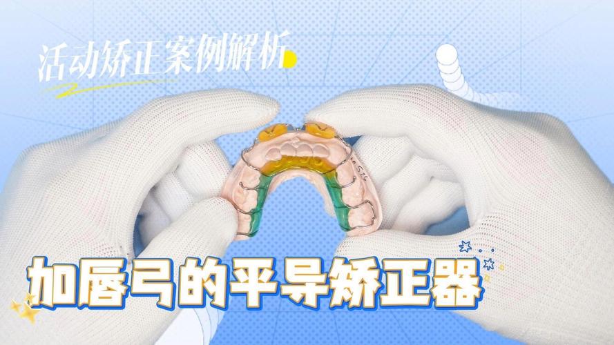 正畸平导3d演示-图1