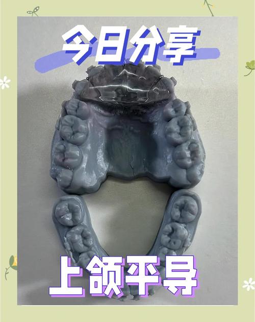 正畸平导3d演示-图3