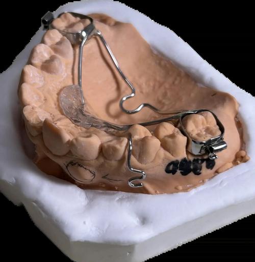 正畸的弓丝有多贵-图2 正畸的弓丝有多贵-图2