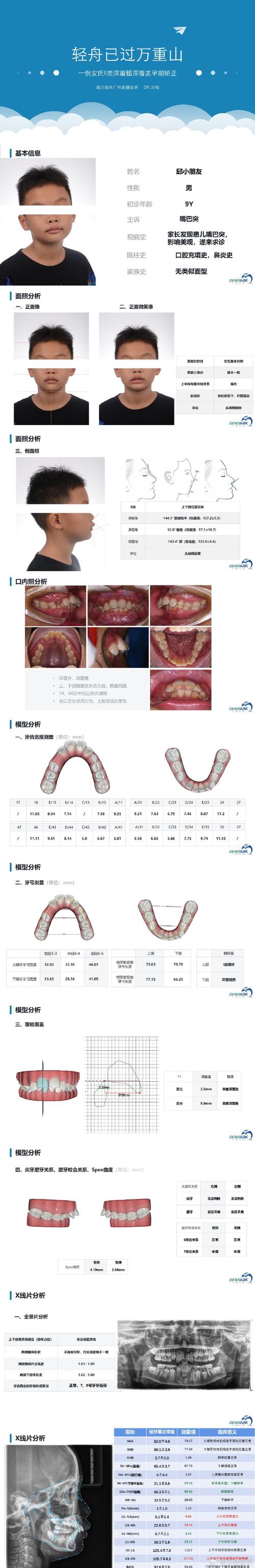 口腔正畸安氏一类是什么？有哪些典型特征与矫正方法？-图3