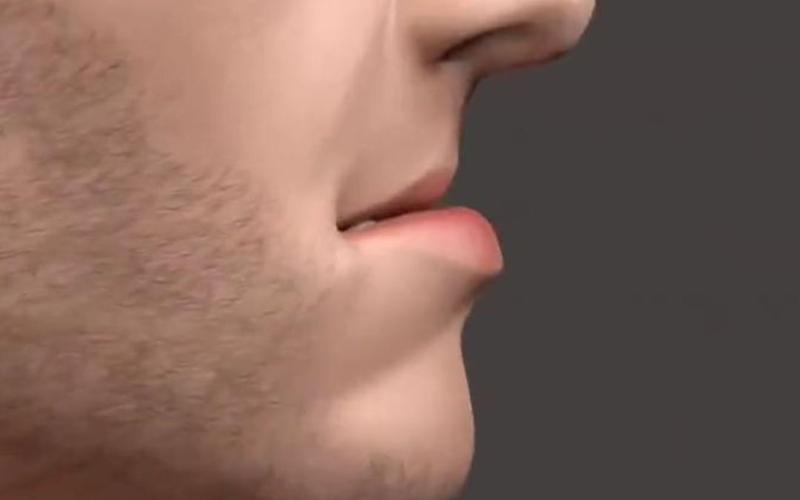 反颌正畸3D视频-图2