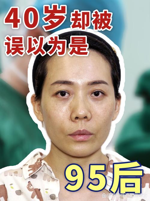 正畸王秀婧好不好-图2 正畸王秀婧好不好-图2