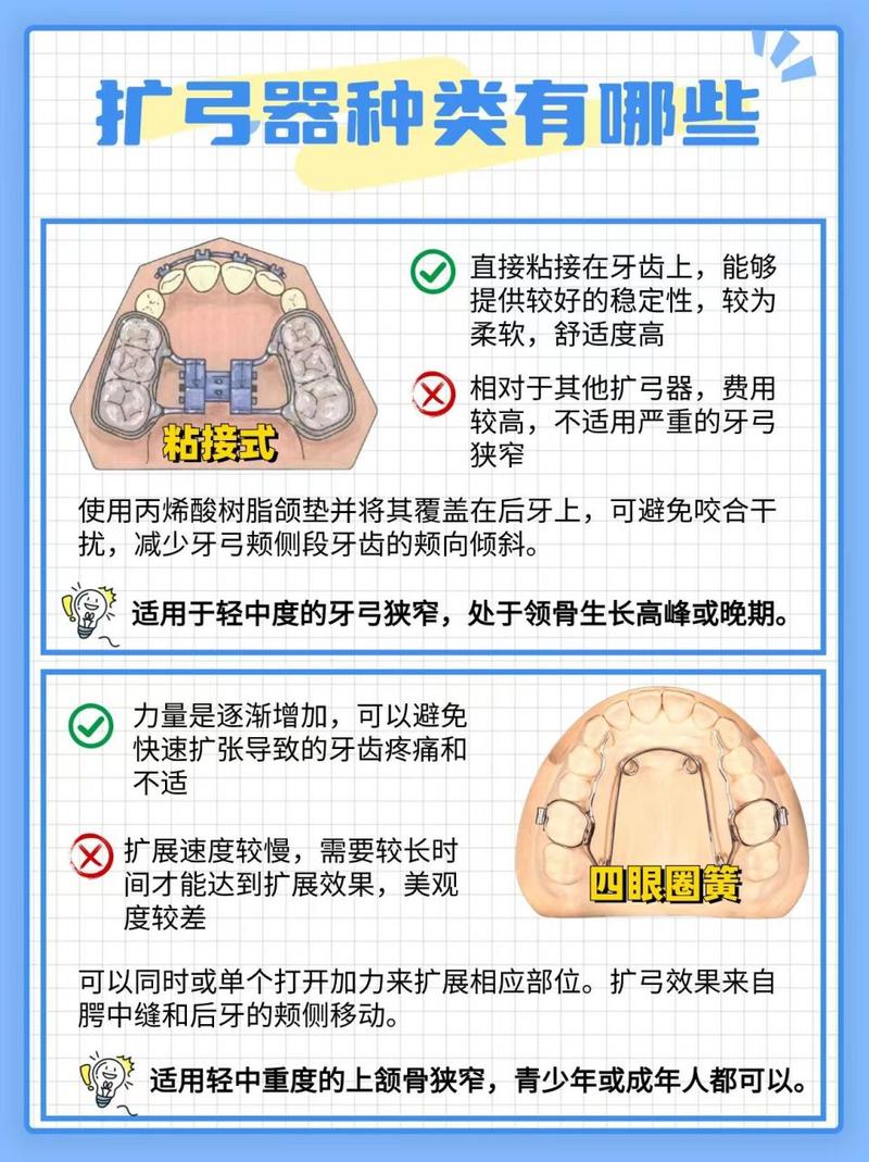 正畸扩弓的适应症-图3