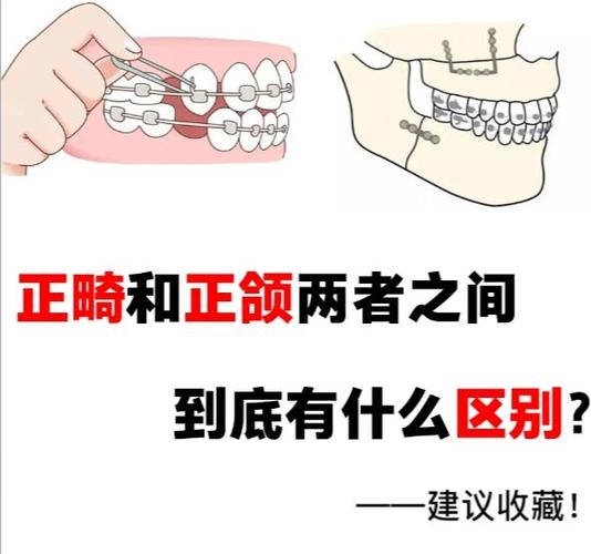 正颌前正畸去哪儿做？医院医生怎么选？费用靠谱吗？-图3