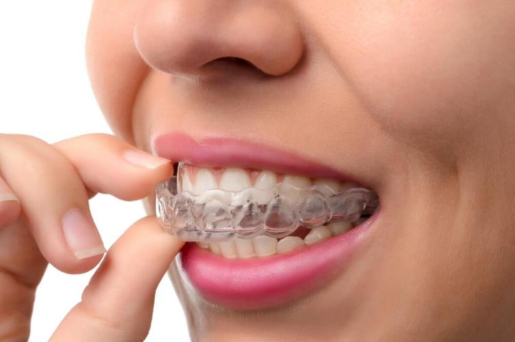 正畸保持器到底有没有用?不戴会反弹吗?-图1 正畸保持器到底有没有用?不戴会反弹吗?-图1