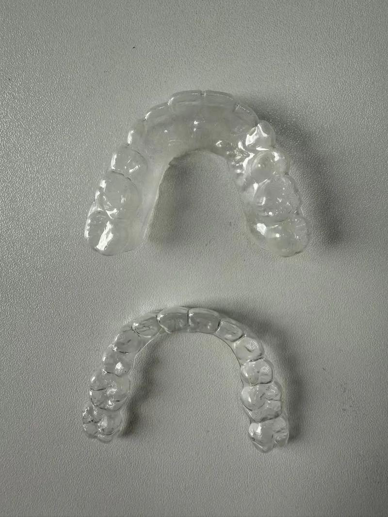 正畸保持器到底有没有用?不戴会反弹吗?-图2 正畸保持器到底有没有用?不戴会反弹吗?-图2