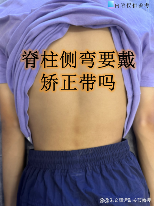 正畸后倾曲效果如何？作用和注意事项有哪些？-图3