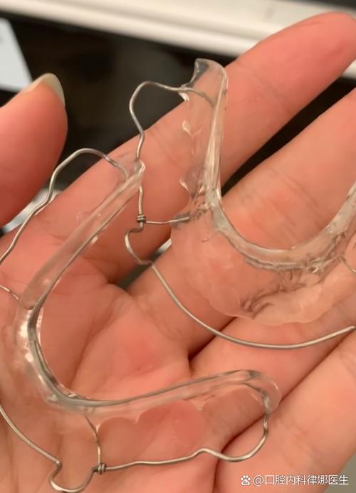 正畸有颗牙活动了-图3