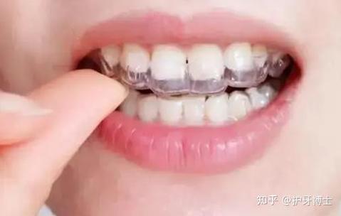 深圳拜博正畸3万-图1