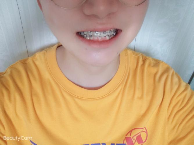 美奥口腔正畸效果如何？价格与服务值得信赖吗？-图2