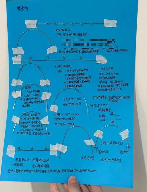 正畸弯制弓丝教材，如何掌握核心弯制技巧？-图2