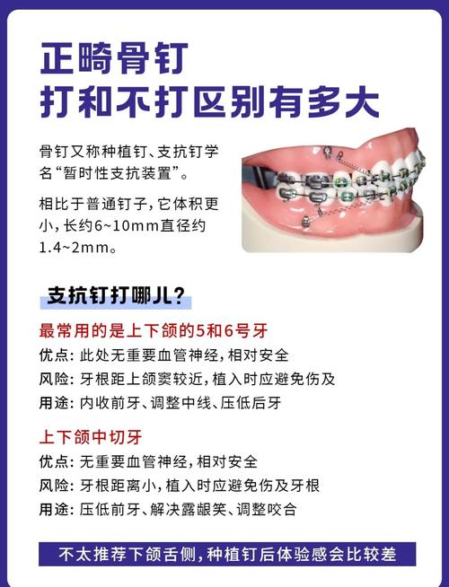 综合性正畸治疗的核心是什么？-图1