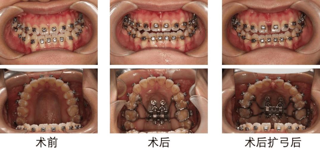 综合性正畸治疗的核心是什么？-图2