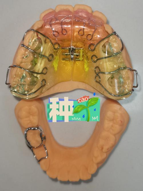 正畸舌簧制作方法-图2