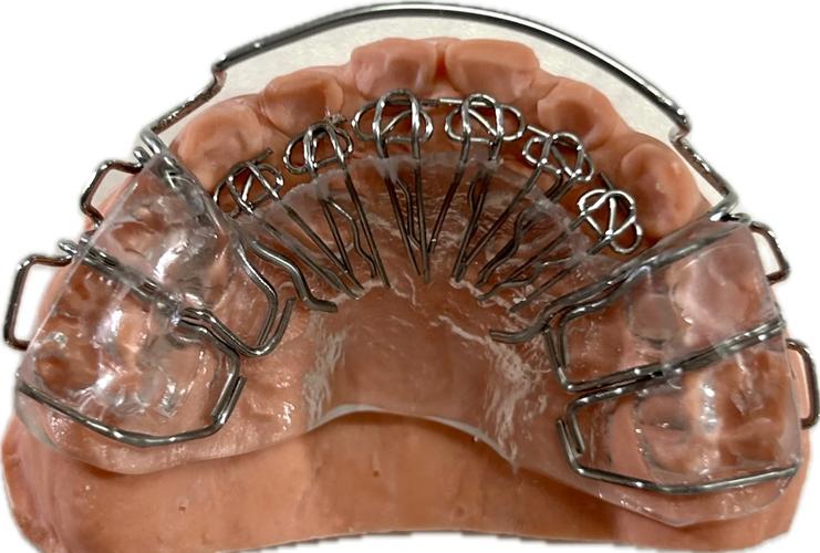 正畸舌簧制作方法-图1