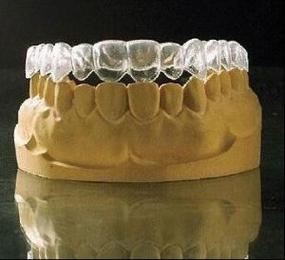 正畸保持器为啥总难摘？原因可能出在这-图3