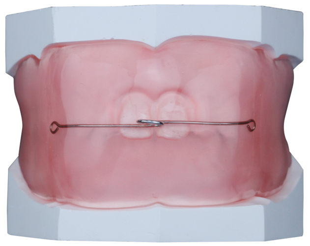 正畸弓丝KQ88-图2