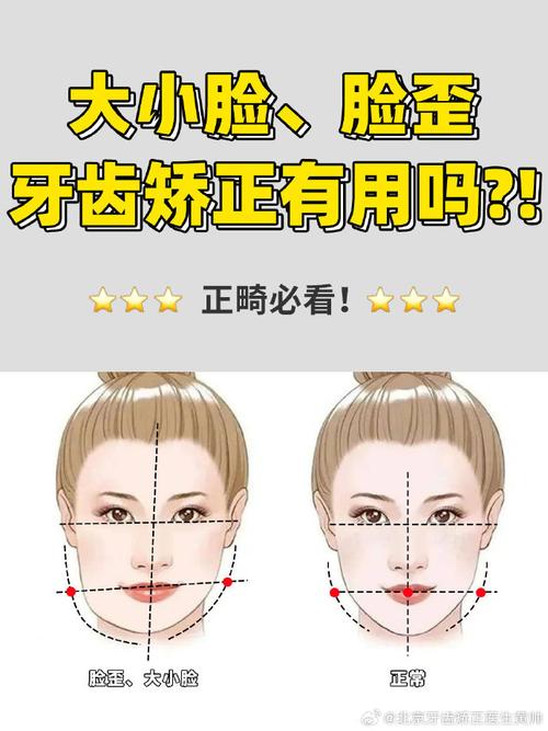 正畸改变脸大小吗-图2