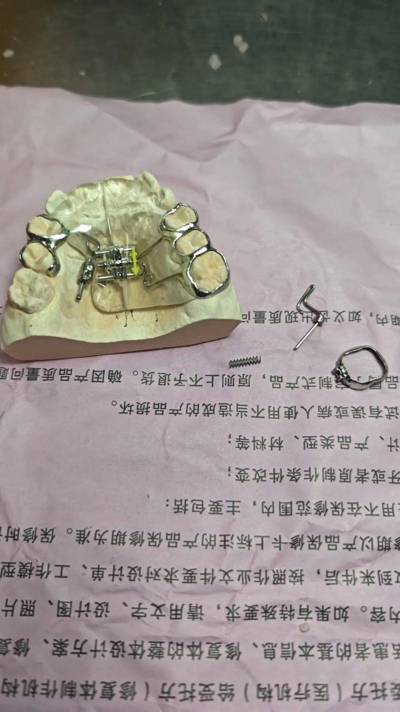 做正畸推簧的步骤-图1