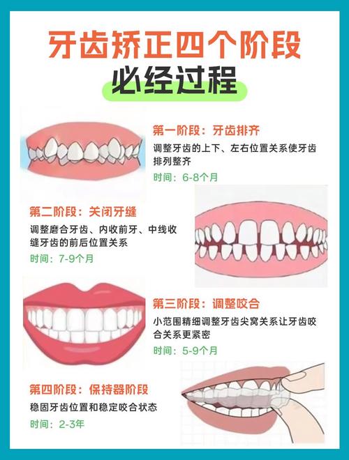 零基础想学正畸方法该怎么入手?-图2 零基础想学正畸方法该怎么入手?-图2