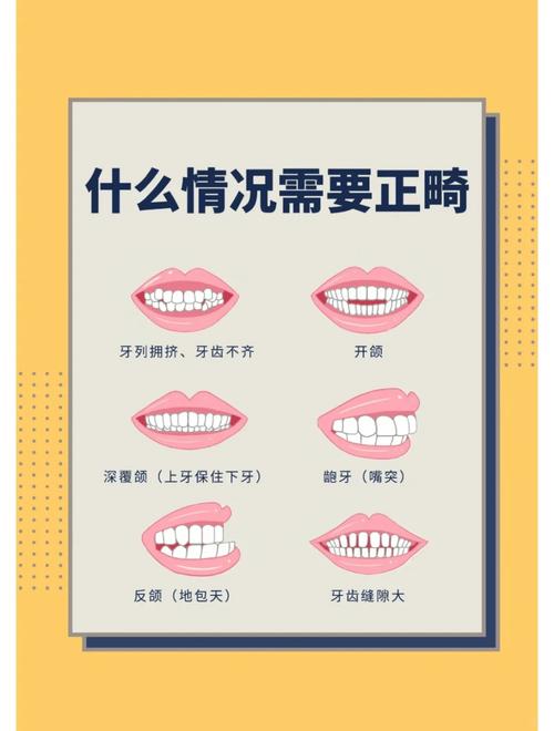 口腔正畸的重要性-图1