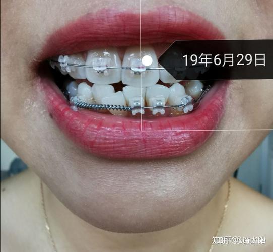 北大口腔进修正畸-图3