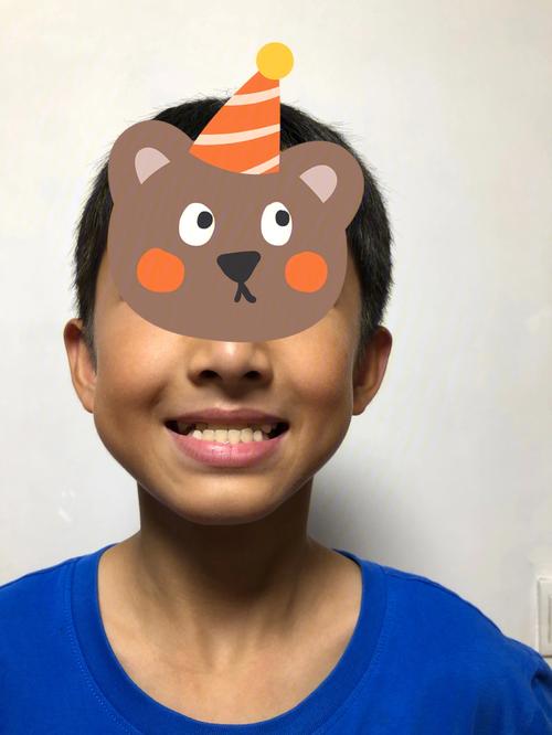 美奥口腔儿童正畸-图1