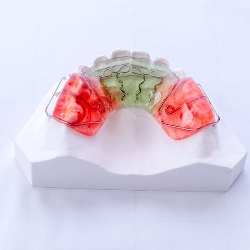 正畸推簧使用会有哪些副作用？-图3