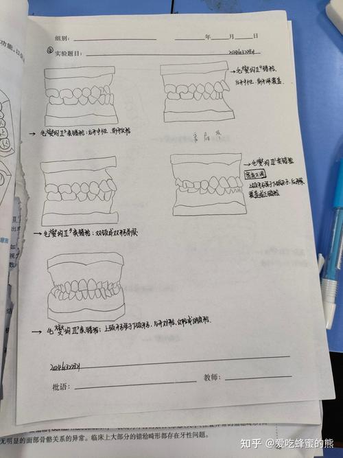 正畸安式错颌分类-图1
