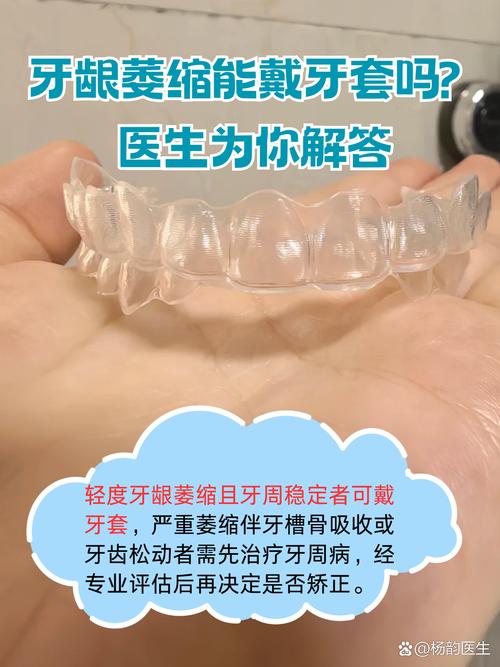 牙龈退缩患者能否进行正畸治疗？-图3