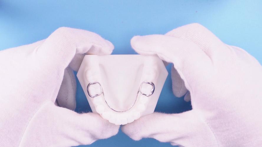 正畸 可摘矫治器-图3 正畸 可摘矫治器-图3