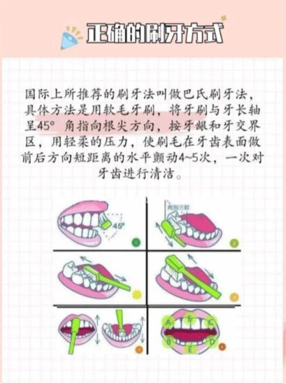 正畸护士轮转报告-图2