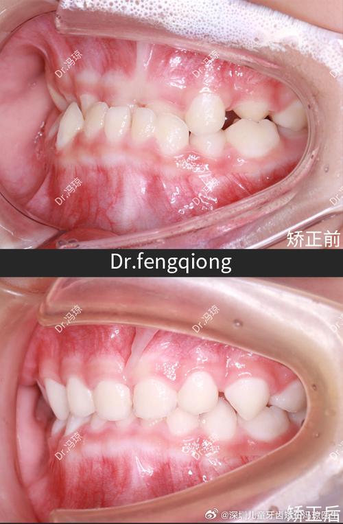 家附近正畸正颌哪家靠谱？选对机构和医生要注意啥？-图2
