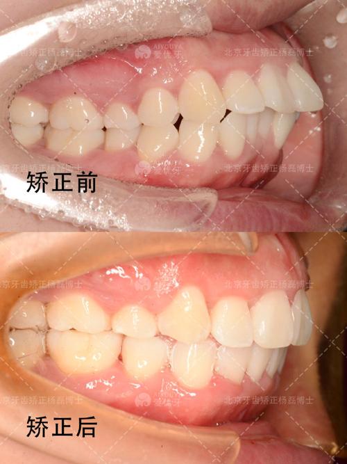 家附近正畸正颌哪家靠谱？选对机构和医生要注意啥？-图3