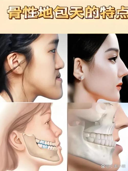 正畸中如何根据面部生长型制定干预策略？-图2