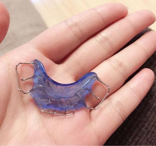 正畸前牙开合牵引如何有效进行？-图3