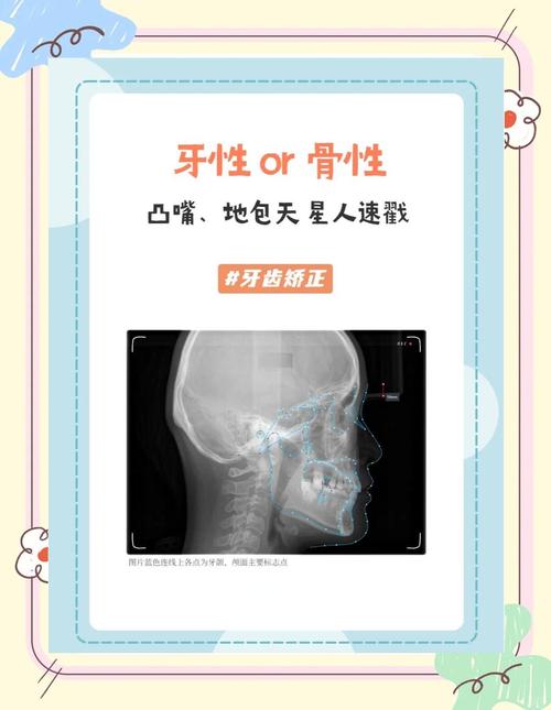 正畸矫正中头影测量如何精准指导治疗？-图2